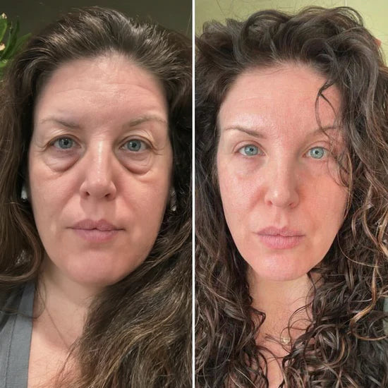 eye cream