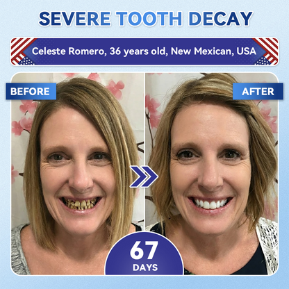 Your Smile~Alivmi® 🦷 Tideglusib Fast-Dissolving Tooth & Gum Repair Oral Strips ✨ 5-in-1 💎 Rebuild Enamel & Dentin • Strengthen Gums • Eradicate Tartar & Odor • Whitening • Stop Tooth Sensitivity