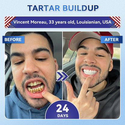 Your Smile~Alivmi® 🦷 Tideglusib Fast-Dissolving Tooth & Gum Repair Oral Strips ✨ 5-in-1 💎 Rebuild Enamel & Dentin • Strengthen Gums • Eradicate Tartar & Odor • Whitening • Stop Tooth Sensitivity