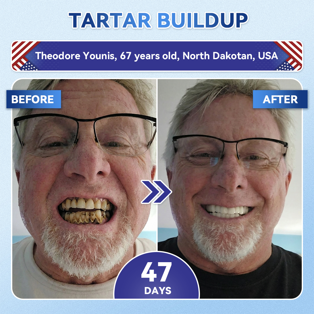 Your Smile~Alivmi® 🦷 Tideglusib Fast-Dissolving Tooth & Gum Repair Oral Strips ✨ 5-in-1 💎 Rebuild Enamel & Dentin • Strengthen Gums • Eradicate Tartar & Odor • Whitening • Stop Tooth Sensitivity