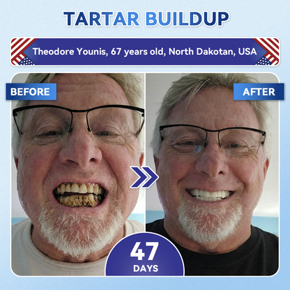 Your Smile~Alivmi® 🦷 Tideglusib Fast-Dissolving Tooth & Gum Repair Oral Strips ✨ 5-in-1 💎 Rebuild Enamel & Dentin • Strengthen Gums • Eradicate Tartar & Odor • Whitening • Stop Tooth Sensitivity