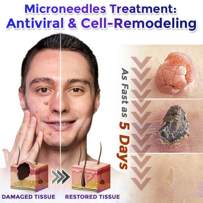 🔥 Final Hours! Save 78% on Alivmi® Microneedle Hydrocolloid Patch Roll – Limited Stock: 58 Units Remaining!