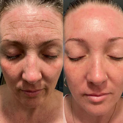 eye cream