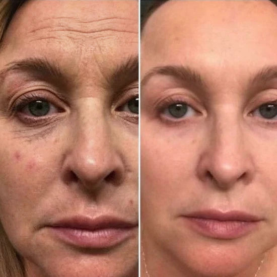 eye cream